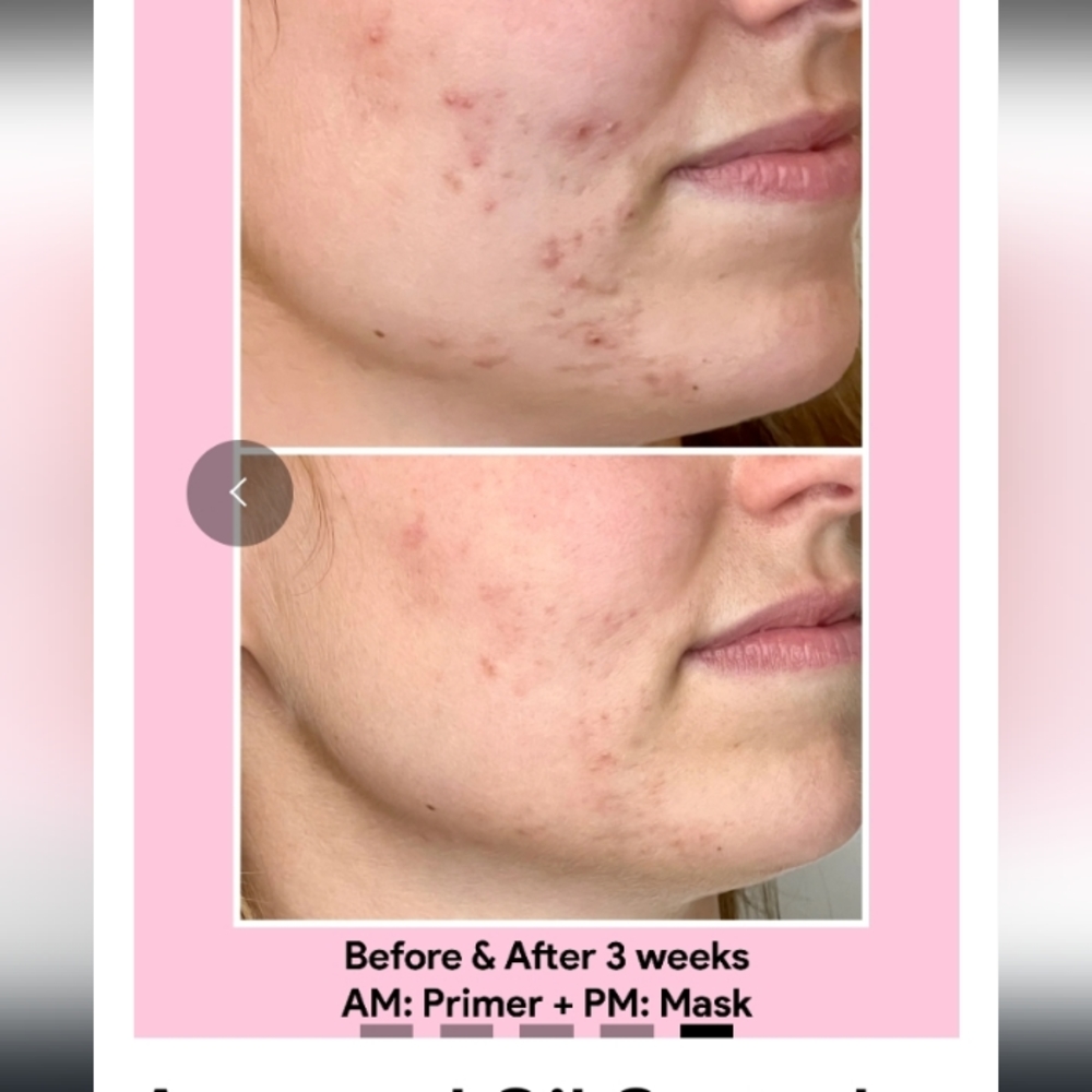 Jori Rx - Picture 4 of 5